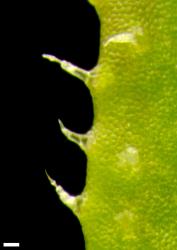 Veronica calycina. Leaf margin. Scale = 0.1 mm.
 Image: P.J. Garnock-Jones © P.J. Garnock-Jones CC-BY-NC 3.0 NZ